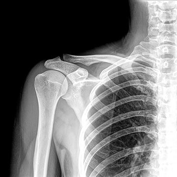 What's the Best Portable X-Ray for Your Needs? - Cover
