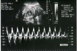 How Sonography Is Speeding up Healthcare - Cover
