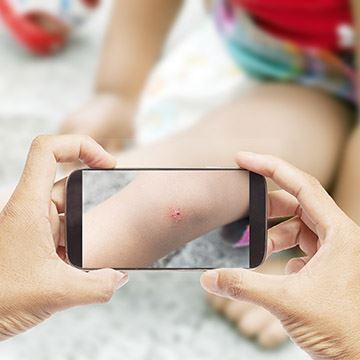 eTech Insight – Smartphones and AI Transforming Dermatology - Cover