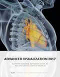 Advanced Visualization 2017: Comprehensive Options Exist in an Unconsolidated World
